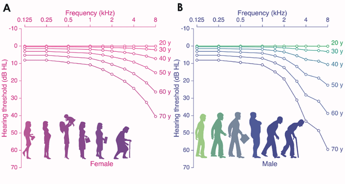 Age-related-hearing-loss-according-to-the-International-Organization-for-Standardization.ppm