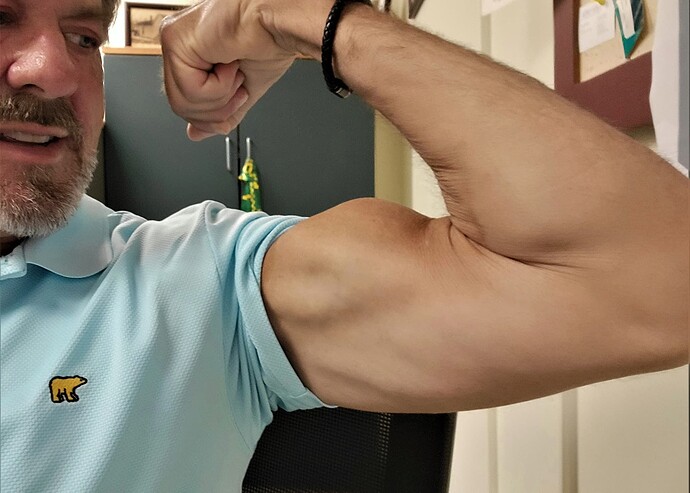 Jason bicep Aug. 1, 2022 (3)