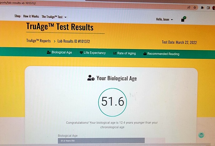 Jason Epigenetic  test - DNA Methylation results  March 2022