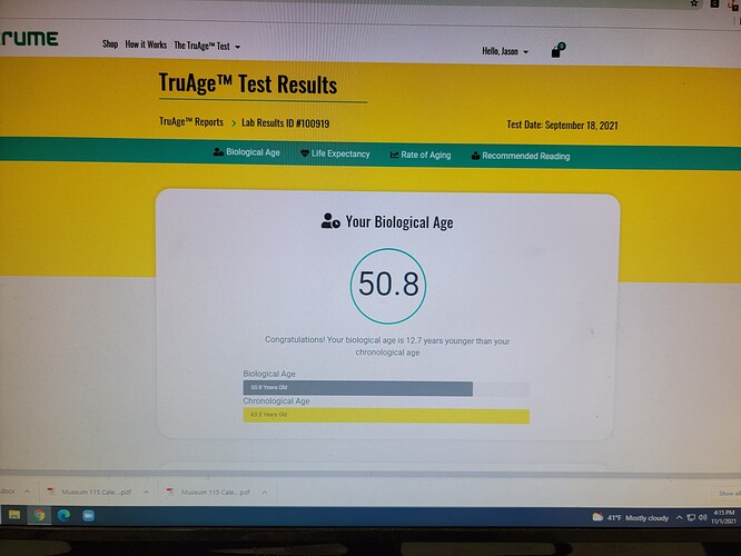 Jason Epigenetic  test - DNA Methylation results