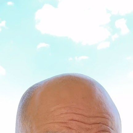 3,511 likes, 268 comments - Peter Attia (@peterattiamd) on Instagram: "The nasty little side effect of even intermittent rapamycin use is shown here. Leave any and all ..."
