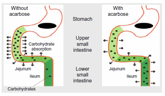 fig1Acarbose