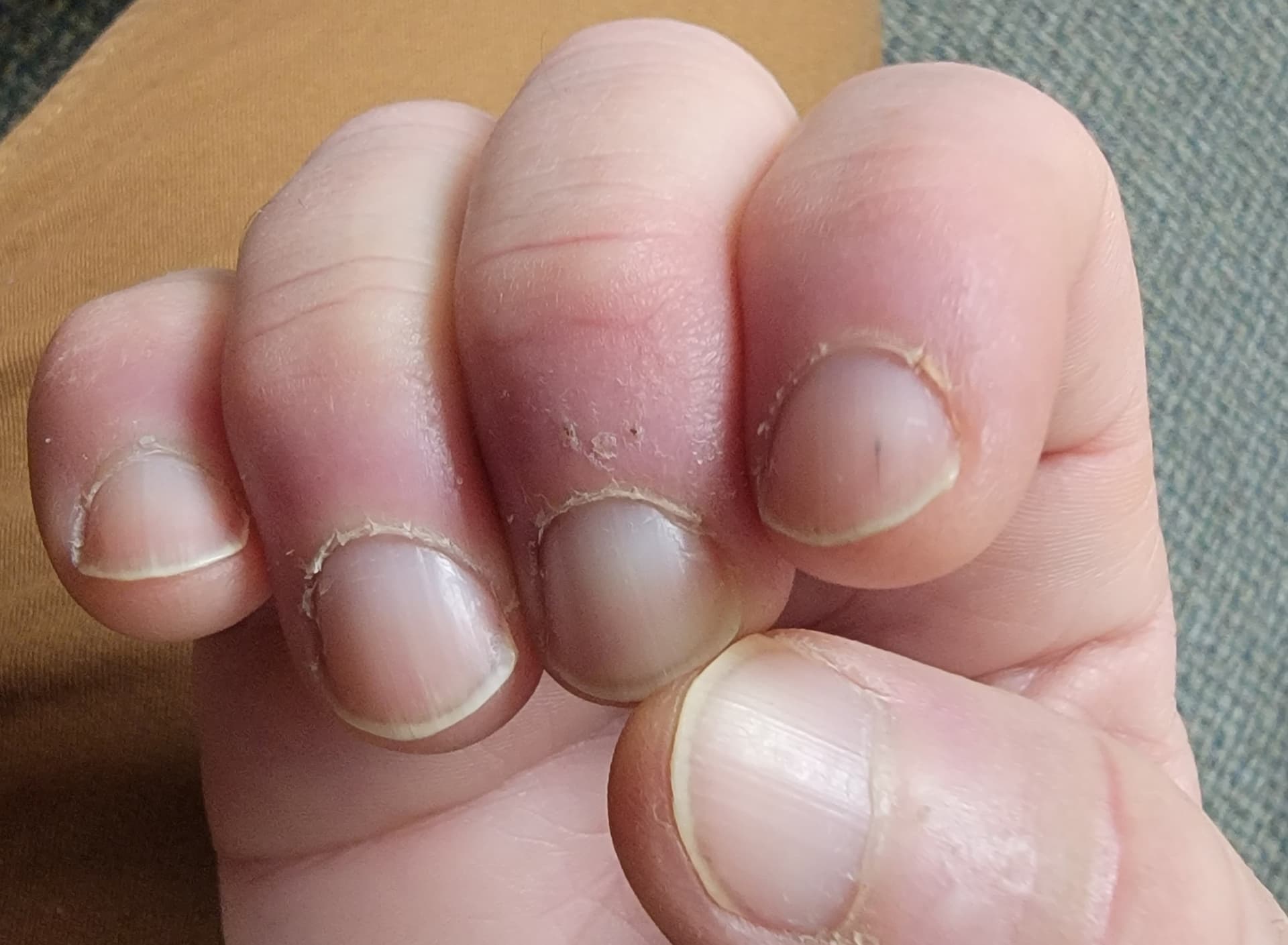 What Your Fingernails Say About Your Health