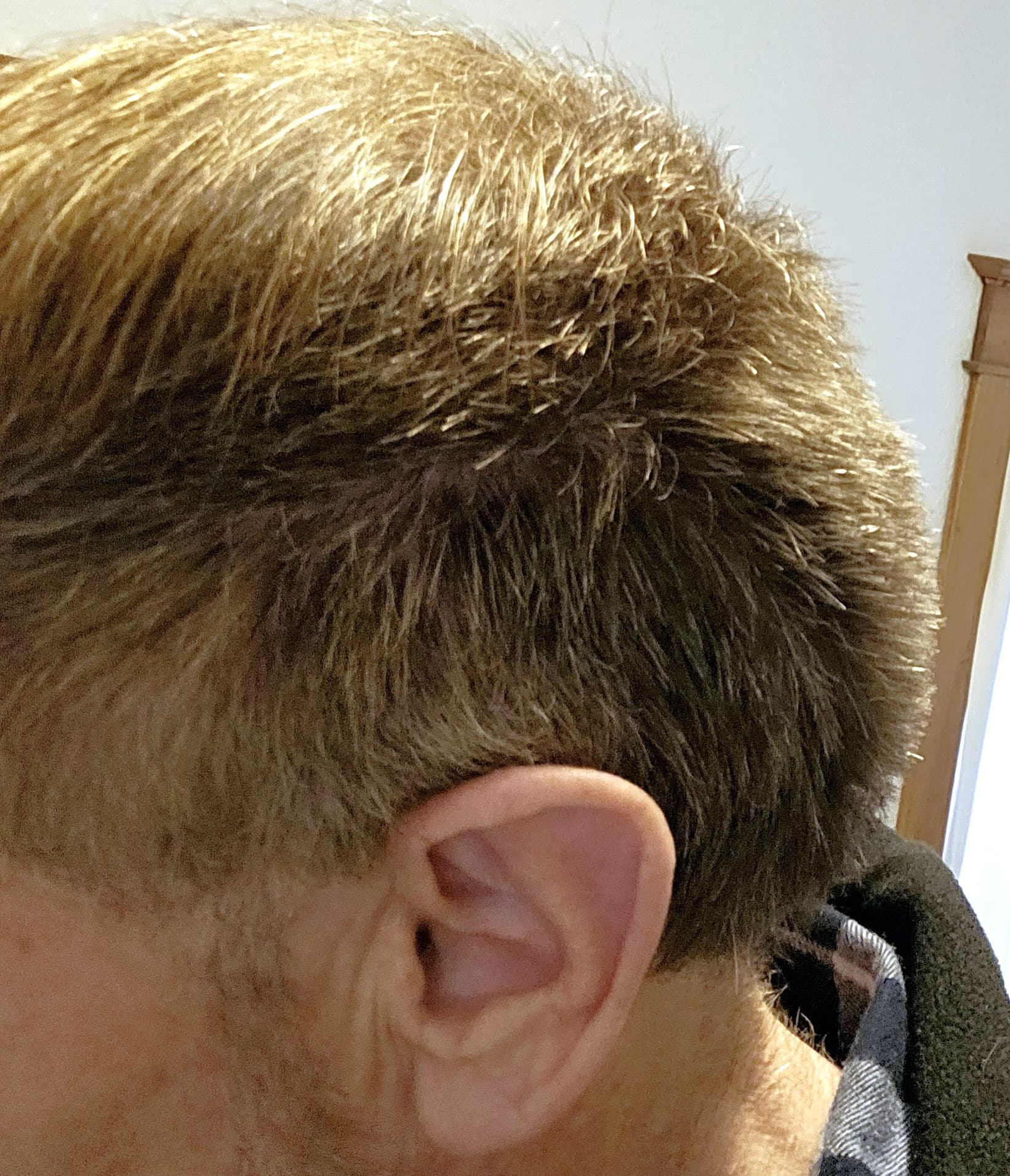 5.  Left side of head growth