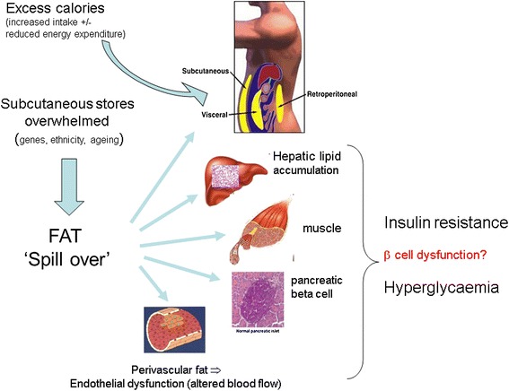 Ectopic-fat-Sattar-2014