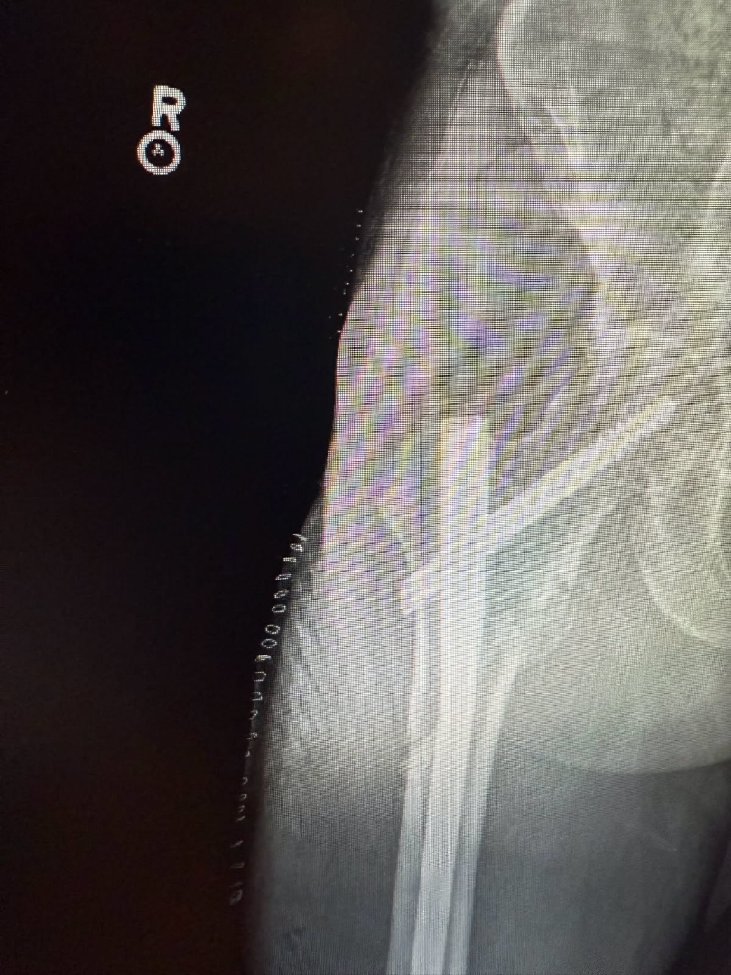 -4488555673013837867