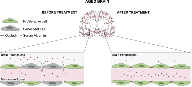 BBB_and_senescence